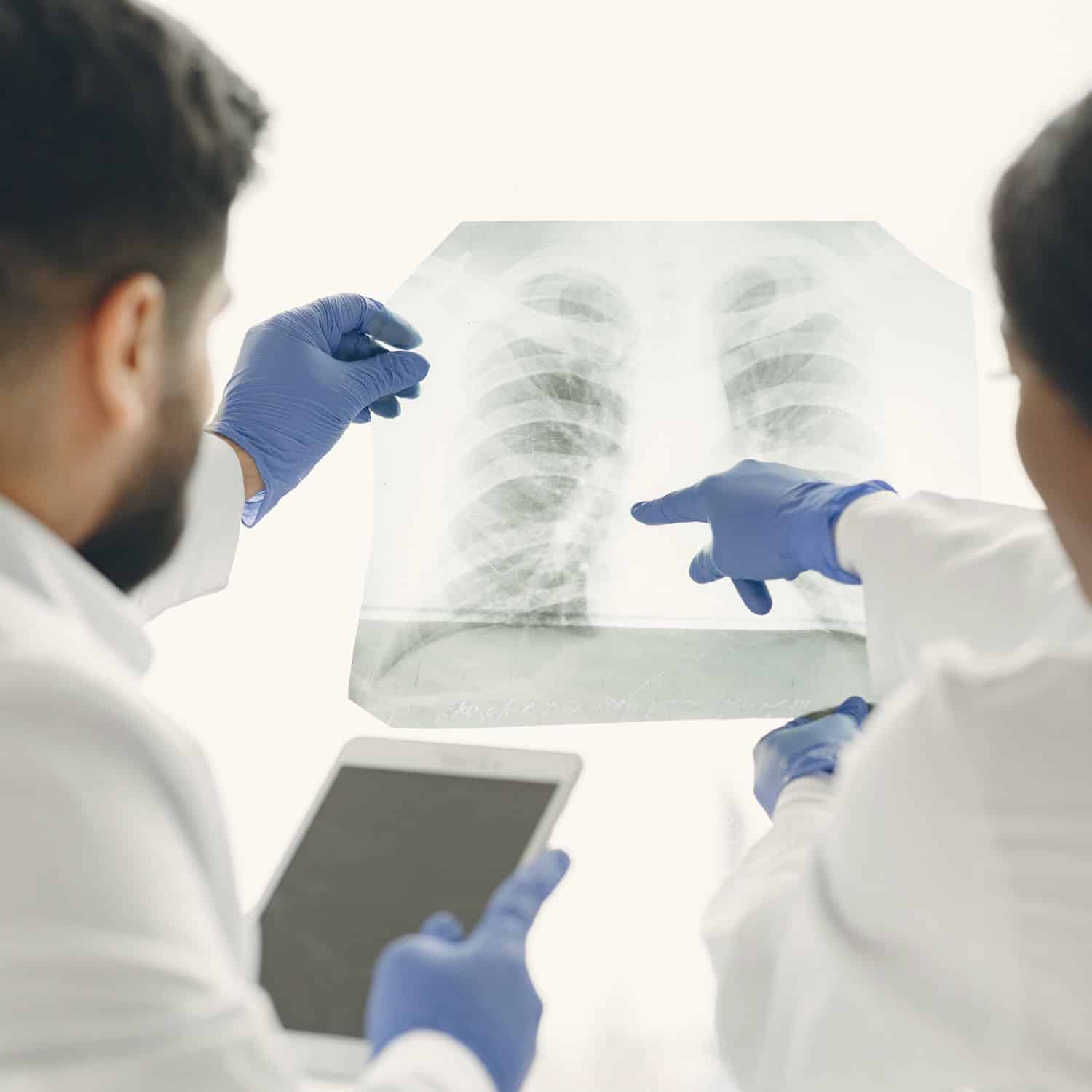 doctors looking at a lung xray at the oakville cardiology clinic
